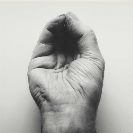 Self-Portrait (Front Hand, Pinched)-1988 Self-Portrait (Front Hand, Pinched)-1988