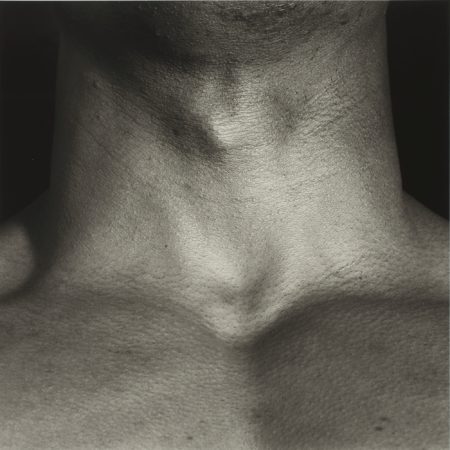 Neck-1988 Neck-1988
