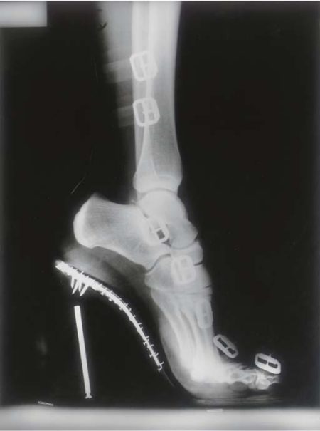X-ray High Heeled Shoe by Karl Lagerfeld, Monte Carlo-1995 X-ray High Heeled Shoe by Karl Lagerfeld, Monte Carlo-1995