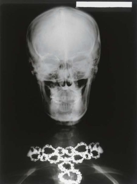 X-ray Of Woman's Skull With Van Cleef And Arpels Necklace (1979)-1979 X-ray Of Woman's Skull With Van Cleef And Arpels Necklace (1979)-1979