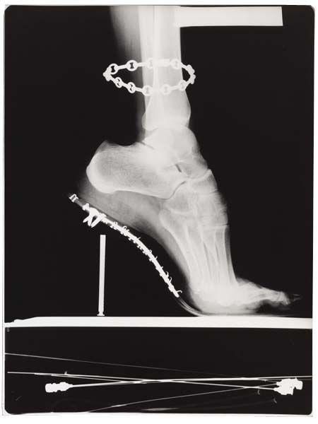 X - Ray with Chain, Paris-1994 X - Ray with Chain, Paris-1994