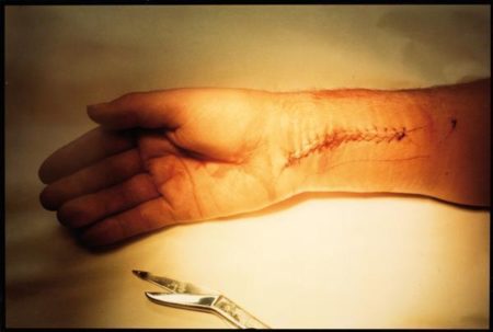 Mick Jagger's Hand, Southampton, Long Island-1975 Mick Jagger's Hand, Southampton, Long Island-1975
