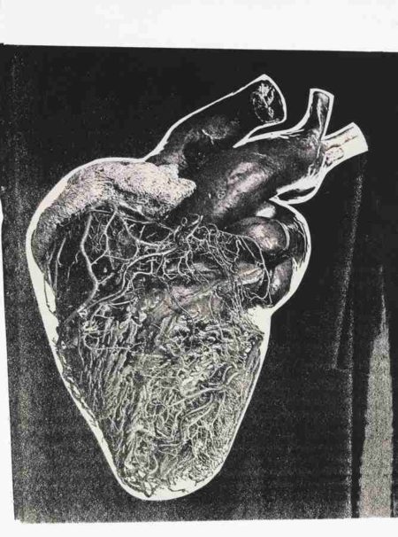 Heart-1979 Heart-1979