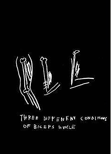 Anatomy (Three Different Conditions of Biceps Muscle)-1982 Anatomy (Three Different Conditions of Biceps Muscle)-1982