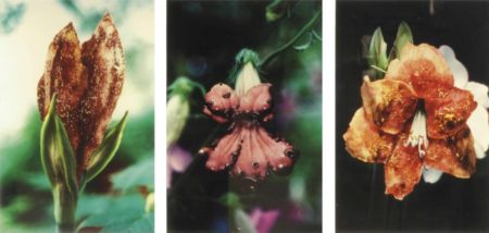 Infectious Flowers (Zoster of Supravicular Dermatomes, Metastases from a malignant melanoma, Intra epidermal carcinoma)-1996 Infectious Flowers (Zoster of Supravicular Dermatomes, Metastases from a malignant melanoma, Intra epidermal carcinoma)-1996