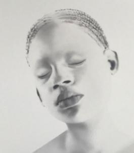 Untitled (albino girl)