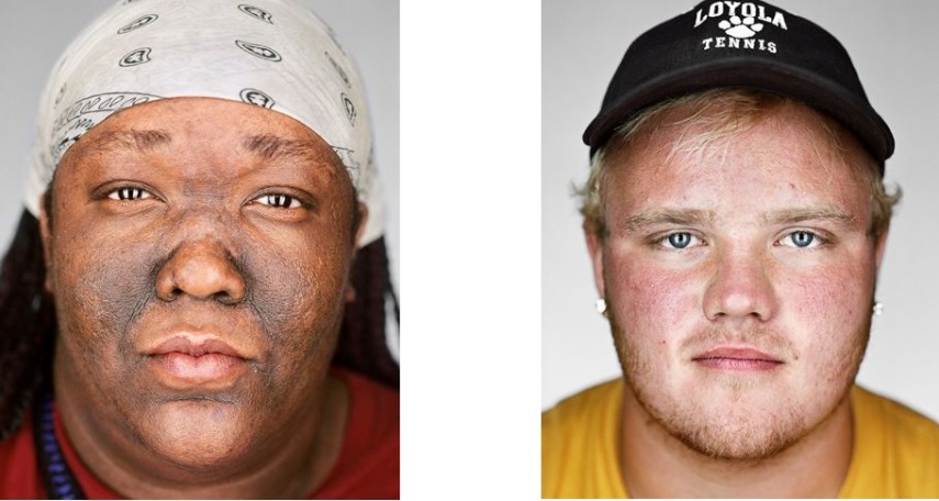 Photographer Martin Schoeller Helps People With No Home in a Fundraiser for GWHFC