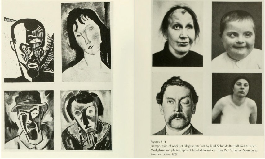 A Juxtaposition of art showing facial deformities by Karl and Amedo