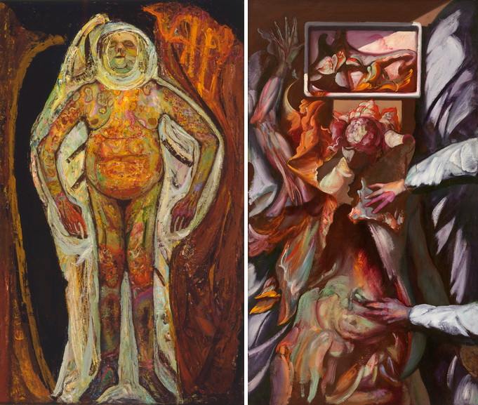 Left Hyman Bloom – Female Corpse Right Hyman Bloom – The Anatomist